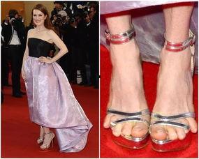 拇指外翻明星,揭秘拇指外翻的明星风采