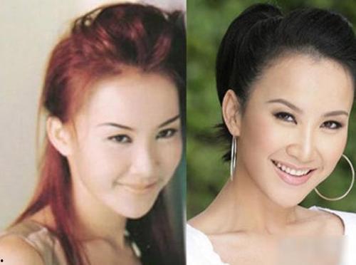 明星一般去哪里整容,揭秘明星们热衷的整形圣地